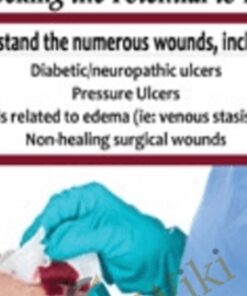 Wound Care: Unlocking the Potential to Heal - Joan Junkin