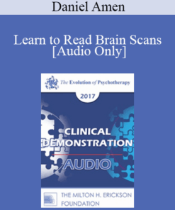 [Audio] EP17 Clinical Demonstration 10 - Learn to Read Brain Scans: 50 cases in 60 Minutes - Daniel Amen