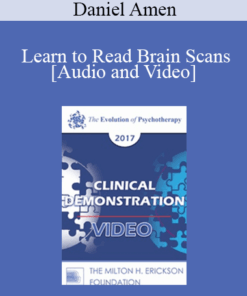 EP17 Clinical Demonstration 10 - Learn to Read Brain Scans: 50 cases in 60 Minutes - Daniel Amen
