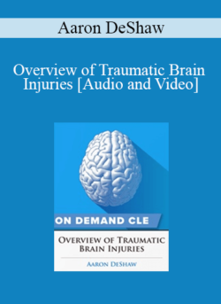 Trial Guides - Overview of Traumatic Brain Injuries