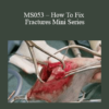 CPD - MS053 – How To Fix Fractures Mini Series