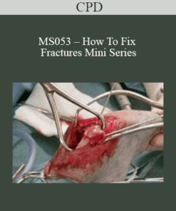 CPD - MS053 – How To Fix Fractures Mini Series