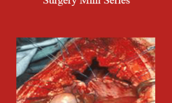 CPD - MS057 – Respiratory Surgery Mini Series