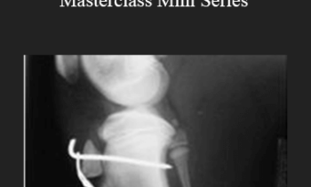 CPD - MS073 – Fracture Masterclass Mini Series