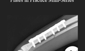 CPD - MS145- How to Use Bone Plates in Practice Mini-Series