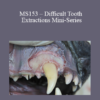 CPD - MS153 – Difficult Tooth Extractions Mini-Series