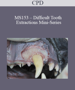 CPD - MS153 – Difficult Tooth Extractions Mini-Series