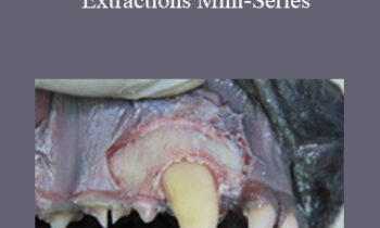 CPD - MS153 – Difficult Tooth Extractions Mini-Series