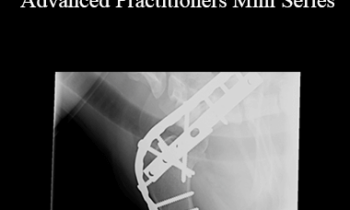 CPD - MS171 Arthrodesis Masterclass for Advanced Practitioners Mini Series
