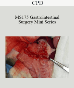 CPD - MS175 Gastrointestinal Surgery Mini Series