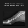 CPD - MS177 Fracture Fixation in General Practice Mini Series