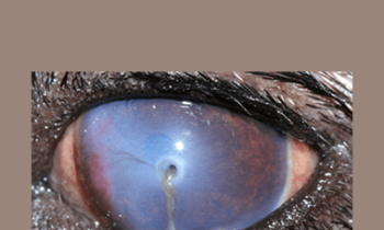 CPD - MS179 Ophthalmic Surgery Mini Series