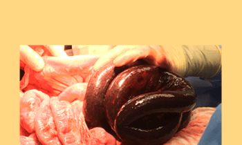 CPD - MS202 – Focus on Emergency Surgery