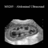 CPD - MS205 – Abdominal Ultrasound