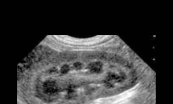 CPD - MS205 – Abdominal Ultrasound