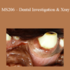 CPD - MS206 – Dental Investigation & Xray