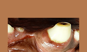 CPD - MS206 – Dental Investigation & Xray