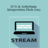 Cynthia L. Webner - ECG & Arrhythmia Interpretation Made Easy