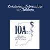 David C Koronkiewicz - Rotational Deformities in Children