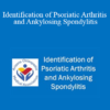 Joy Schechtman - Identification of Psoriatic Arthritis and Ankylosing Spondylitis