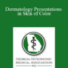 Nathan Cleaver - Dermatology Presentations in Skin of Color