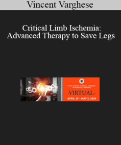 Vincent Varghese - Critical Limb Ischemia: Advanced Therapy to Save Legs